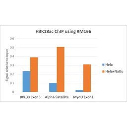 Anti-Histone H3K18ac (Acetyl Lys18) antibody [RM166] used in ChIP assay (ChIP assay). GTX60886