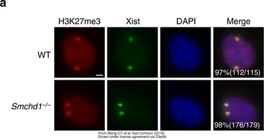 Anti-Histone H3K27me3 (Tri-methyl Lys27) antibody [RM175] used in Immunocytochemistry/ Immunofluorescence (ICC/IF). GTX60892