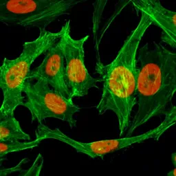 Anti-Histone H3K9me1 (Mono-methyl Lys9) antibody [RM150] used in Immunocytochemistry/ Immunofluorescence (ICC/IF). GTX60894
