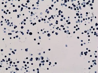 Anti-Histone H3K56ac (Acetyl Lys56) antibody [RM179] used in Immunocytochemistry/ Immunofluorescence (ICC/IF). GTX60902