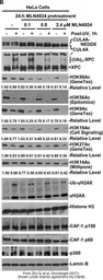 Anti-Histone H3K56ac (Acetyl Lys56) antibody [RM179] used in Western Blot (WB). GTX60902