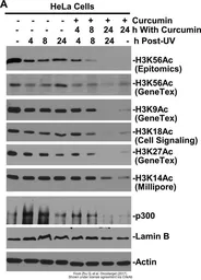 Anti-Histone H3K56ac (Acetyl Lys56) antibody [RM179] used in Western Blot (WB). GTX60902