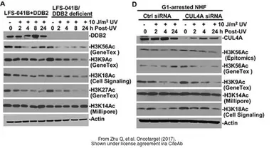 Anti-Histone H3K56ac (Acetyl Lys56) antibody [RM179] used in Western Blot (WB). GTX60902