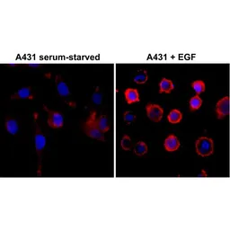 Anti-Phosphotyrosine antibody [RM111] used in Immunocytochemistry/ Immunofluorescence (ICC/IF). GTX60918