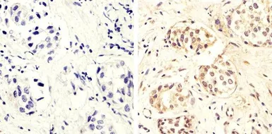 Anti-PTEN (phospho Ser370) antibody used in IHC (Paraffin sections) (IHC-P). GTX60929