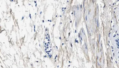Anti-Collagen III antibody [1E7-D7/Col3] used in IHC (Paraffin sections) (IHC-P). GTX60940