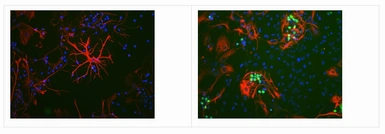 Anti-c-Fos antibody [2H2] used in Immunocytochemistry/ Immunofluorescence (ICC/IF). GTX60996