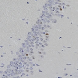 Anti-c-Fos antibody [2H2] used in IHC (Paraffin sections) (IHC-P). GTX60996
