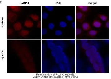 Anti-PARP (p116/p85) antibody [E78], C-term used in Immunocytochemistry/ Immunofluorescence (ICC/IF). GTX61031