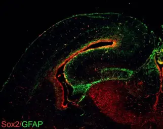 Anti-SOX2 antibody [GT1352] used in IHC (Frozen sections) (IHC-Fr). GTX627405