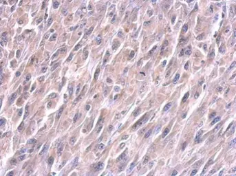 Anti-Lin28A antibody [GT717] used in IHC (Paraffin sections) (IHC-P). GTX628138