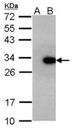 Anti-Lin28A antibody [GT717] used in Western Blot (WB). GTX628138