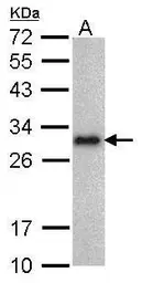 Anti-Lin28A antibody [GT717] used in Western Blot (WB). GTX628138