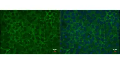 Anti-Lin28A antibody [GT1086] used in Immunocytochemistry/ Immunofluorescence (ICC/IF). GTX628139