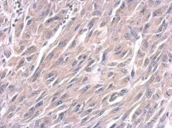 Anti-Lin28A antibody [GT1086] used in IHC (Paraffin sections) (IHC-P). GTX628139