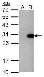 Anti-Lin28A antibody [GT1086] used in Western Blot (WB). GTX628139