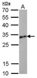 Anti-Lin28A antibody [GT1086] used in Western Blot (WB). GTX628139