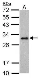 Anti-Lin28A antibody [GT1086] used in Western Blot (WB). GTX628139