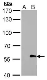 Anti-Myc tag antibody [GT0002] (HRP) used in Western Blot (WB). GTX628259-01