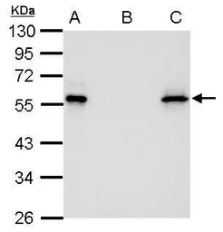 Anti-Myc tag antibody [GT0002] used in Immunoprecipitation (IP). GTX628259