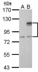 Anti-SUPV3L1 antibody [GT244] used in Western Blot (WB). GTX628260