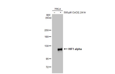 Anti-HIF1 alpha antibody [GT10211] used in Western Blot (WB). GTX628480