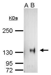 Anti-HA tag antibody [GT423] used in Immunoprecipitation (IP). GTX628489