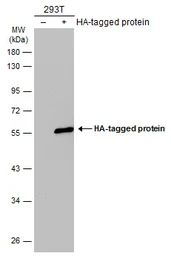 Anti-HA tag antibody [GT423] used in Western Blot (WB). GTX628489