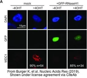 Anti-GFP antibody [GT859] used in Immunocytochemistry/ Immunofluorescence (ICC/IF). GTX628528
