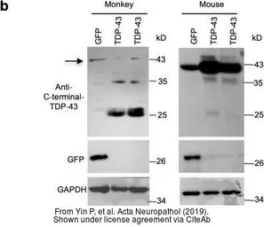 Anti-GFP antibody [GT859] used in Western Blot (WB). GTX628528