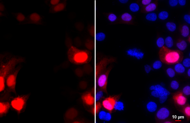 Anti-GFP antibody [GT859] used in Immunocytochemistry/ Immunofluorescence (ICC/IF). GTX628528