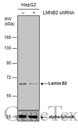 Anti-Lamin B2 antibody [GT144] used in Western Blot (WB). GTX628803