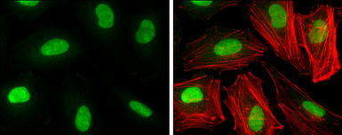 Anti-HMGB1 antibody [GT348] used in Immunocytochemistry/ Immunofluorescence (ICC/IF). GTX628835