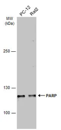 Anti-PARP antibody [GT6212] used in Western Blot (WB). GTX628836