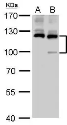 Anti-PARP antibody [GT6212] used in Western Blot (WB). GTX628836