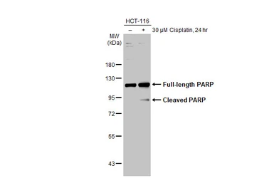 Anti-PARP antibody [GT6212] used in Western Blot (WB). GTX628836