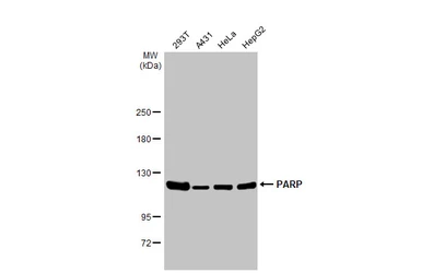 Anti-PARP antibody [GT6212] used in Western Blot (WB). GTX628836