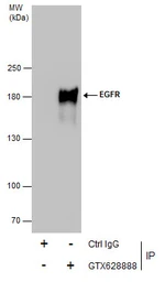Anti-EGFR antibody [GT461] used in Immunoprecipitation (IP). GTX628888