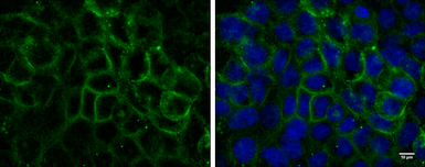 Anti-EGFR antibody [GT461] used in Immunocytochemistry/ Immunofluorescence (ICC/IF). GTX628888