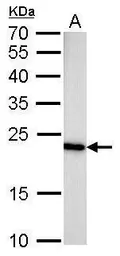 Anti-Glyoxalase I antibody [GT552] used in Western Blot (WB). GTX628890