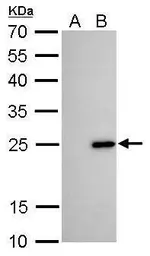 Anti-Bcl-2 antibody [GT11210] used in Western Blot (WB). GTX628905