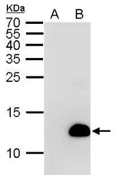 Anti-6X His tag antibody [GT359] (HRP) used in Western Blot (WB). GTX628914-01