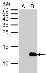 Anti-6X His tag antibody [GT359] used in Western Blot (WB). GTX628914