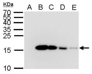Anti-6X His tag antibody [GT359] used in Western Blot (WB). GTX628914