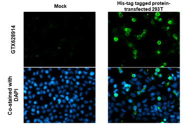 Anti-6X His tag antibody [GT359] used in Immunocytochemistry/ Immunofluorescence (ICC/IF). GTX628914