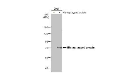 Anti-6X His tag antibody [GT359] used in Western Blot (WB). GTX628914
