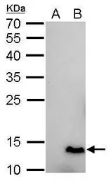 Anti-6X His tag antibody [GT161] used in Western Blot (WB). GTX628921
