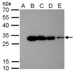 Anti-6X His tag antibody [GT161] used in Western Blot (WB). GTX628921