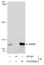 Anti-ADAR1 antibody [GT1066] used in Immunoprecipitation (IP). GTX629000