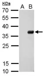 Anti-S Tag antibody [GT727] used in Western Blot (WB). GTX629074